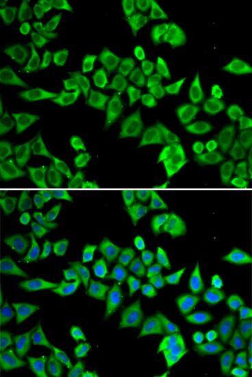 Anti-DDX20 Antibody (CAB5817)