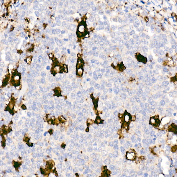 Immunohistochemistry of paraffin-embedded human tonsil using CD68 antibody at dilution of 1:50 (40x lens). Perform high pressure antigen retrieval with 10 mM citrate buffer pH 6. 0 before commencing with IHC staining protocol.