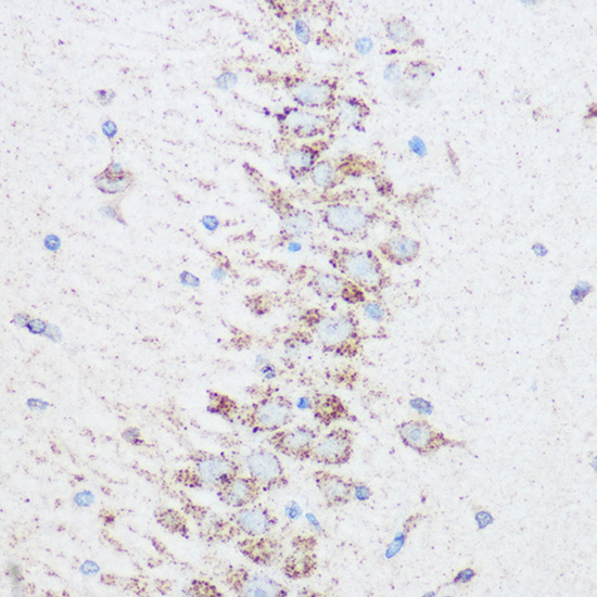 Anti-SIRT4 Antibody (CAB7585)