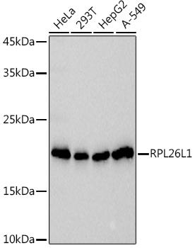 Western blot analysis of extracts of various cell lines, using at 1:1000 dilution. Secondary antibody: HRP Goat Anti-Rabbit IgG (H+L) at 1:10000 dilution. Lysates/proteins: 25ug per lane. Blocking buffer: 3% nonfat dry milk in TBST. Detection: ECL Basic Kit. Exposure time: 3s.