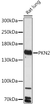 Anti-PKN2 Antibody (CAB18373)