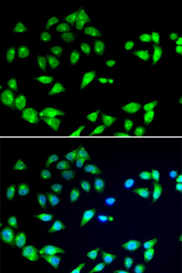 Anti-ARFGAP1 Antibody (CAB12595)