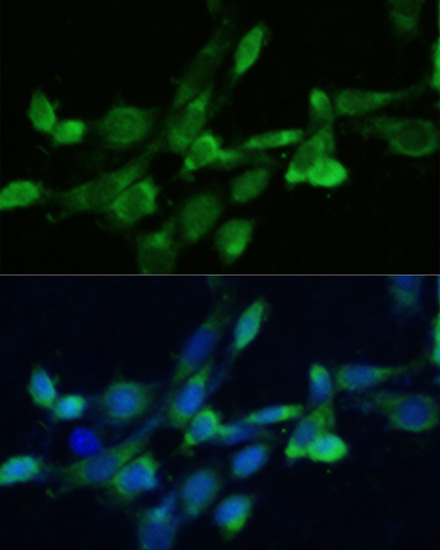 Anti-SQS/FDFT1 Antibody (CAB6229)