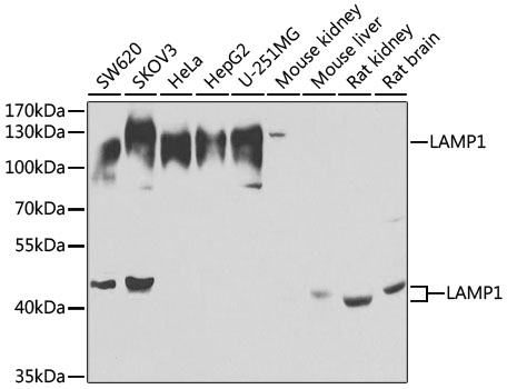 Anti-LAMP1 Antibody (CAB2582)