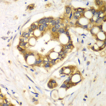 Anti-RPH3A Antibody (CAB13584)