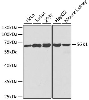 Anti-SGK1 Antibody (CAB1025)