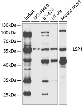 Anti-LSP1 Antibody (CAB13624)