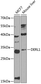 Anti-Derlin-1 Polyclonal Antibody (CAB8508)