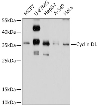 Anti-Cyclin D1 Antibody (CAB2708)