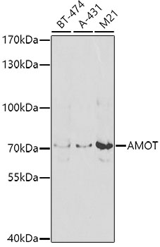 Anti-Angiomotin Polyclonal Antibody (CAB8075)