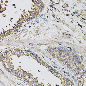 Anti-GRN Antibody (CAB12440)