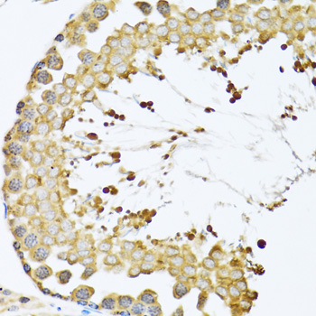 Anti-CCT4 Antibody (CAB6548)