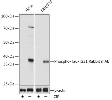 Anti-Phospho-Tau-T231 Antibody (CABP0053)