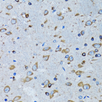 Anti-RARS Antibody (CAB6307)