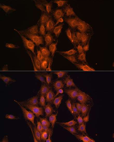 Anti-NF2 Antibody [KO Validated] (CAB0739)