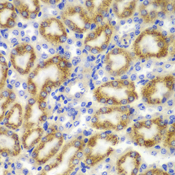 Anti-RANKL Antibody (CAB13567)