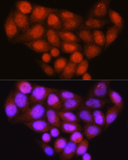 Anti-BRCA1 Antibody (CAB0212)