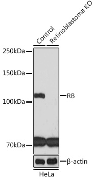 Anti-RB Antibody [KO Validated] (CAB3618)