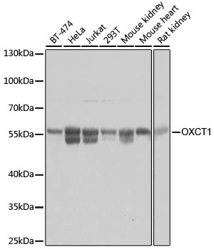 Anti-OXCT1 Polyclonal Antibody [KO Validated] (CAB8139)