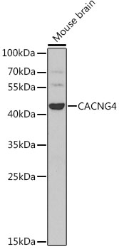 Anti-CACNG4 Antibody (CAB7588)