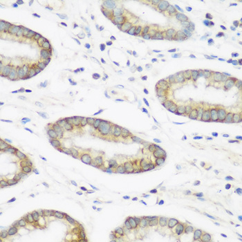 Anti-NEDD4 Antibody (CAB0552)