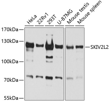 Anti-SKIV2L2 Antibody (CAB5576)