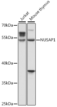 Anti-NUSAP1 Antibody (CAB16000)