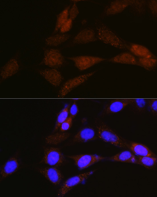 Anti-NRBF2 Antibody (CAB13422)