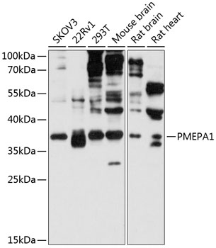 Anti-PMEPA1 Antibody (CAB12171)