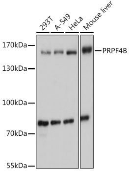 Anti-PRPF4B Antibody (CAB14815)