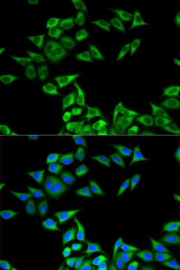 Anti-CHMP2B Antibody (CAB13410)