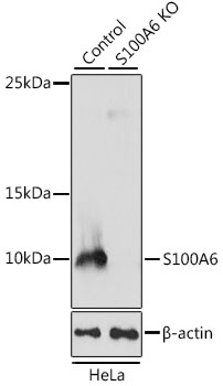 Anti-S100A6 Antibody [KO Validated] (CAB4104)