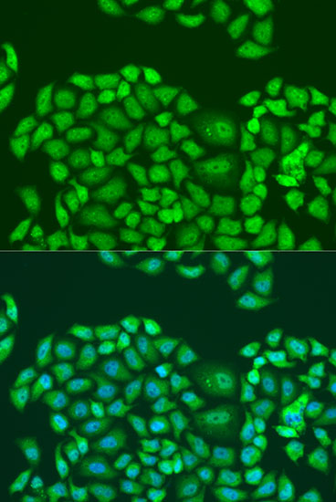 Anti-SMN2 Antibody (CAB12519)