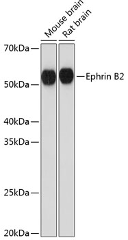 Anti-Ephrin B2 Antibody