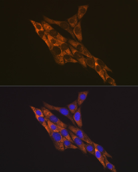 Anti-RPS6 Antibody (CAB6058)