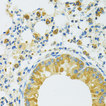Anti-SLC37A4 Antibody (CAB14564)