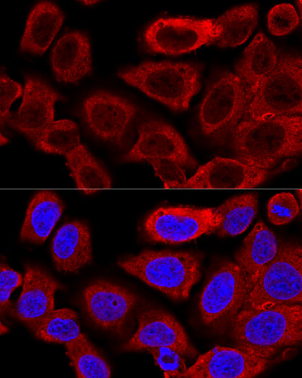 Anti-DRP1 Antibody [KO Validated] (CAB17069)