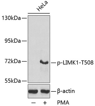 Anti-Phospho-LIM domain kinase 1-T508 Antibody (CABP0387)