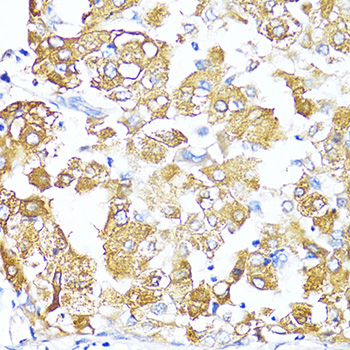 Anti-TGFB2 Antibody (CAB16226)