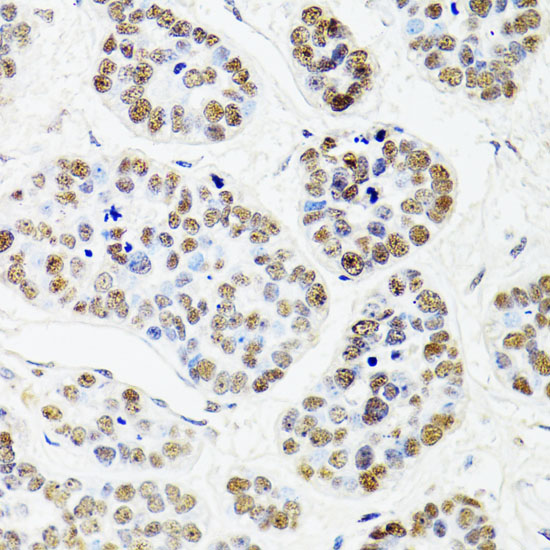 Anti-CDX2 Antibody (CAB1629)