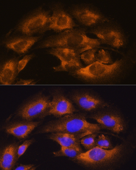 Anti-ANPEP Antibody (CAB5662)