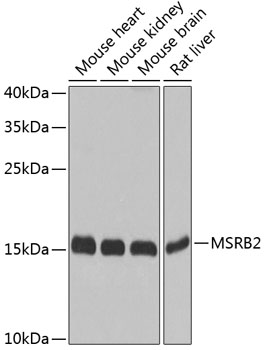 Anti-MSRB2 Polyclonal Antibody (CAB8364)