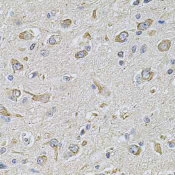 Anti-FASTKD1 Antibody (CAB7384)