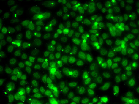 Anti-RPA3 Antibody (CAB14058)