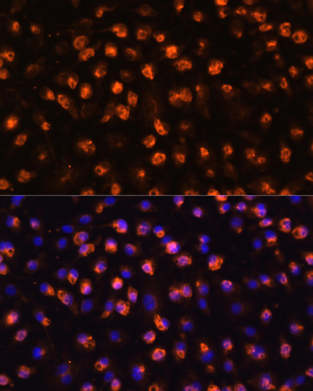 Anti-CD11B Antibody (CAB1581)