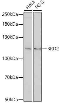 Anti-BRD2 Antibody (CAB18229)