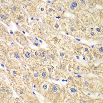 Anti-ACADS Antibody (CAB0945)