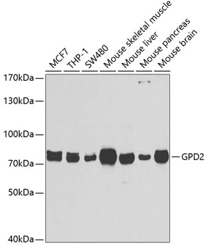 Anti-GPD2 Antibody (CAB6611)