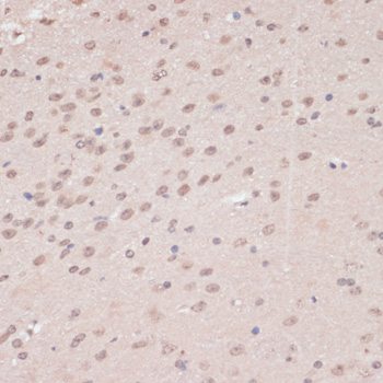 Anti-PRPF31 Antibody (CAB5732)