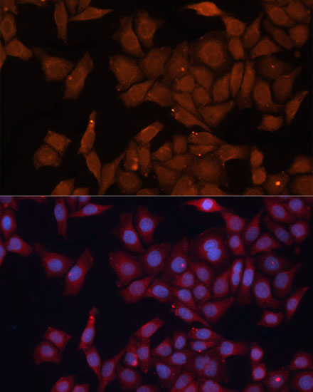 Anti-HMGCS1 Antibody (CAB3916)